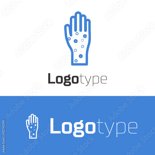 Blue line Hand with psoriasis or eczema icon isolated on white background. Concept of human skin response to allergen or chronic body problem. Logo design template element. Vector Illustration