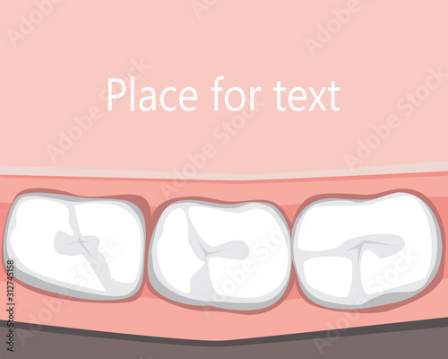 A flat teeth after visiting the dentist or orthodontist and place for text, a vector stock illustration with gum, molar and copyspace