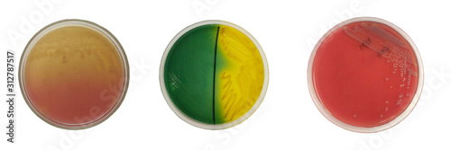 Εκτύπωση καμβά Close up media culture bacteria.