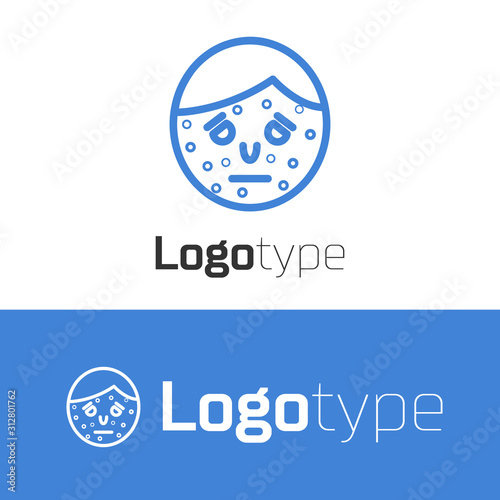 Blue line Face with psoriasis or eczema icon isolated on white background. Concept of human skin response to allergen or chronic body problem. Logo design template element. Vector Illustration