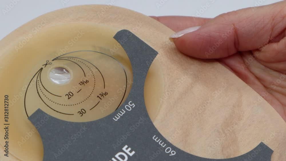 Colostomy bag, supply needed after colostomy surgery colon cancer