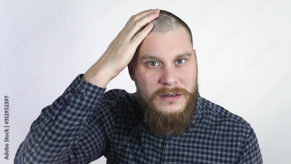 Human alopecia or hair loss.Adult man hand pointing his bald head. Human alopecia or hair loss.Adult man hand pointing his bald head.
