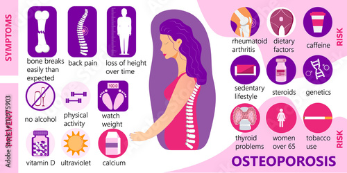 Osteoporosis infographic, osteoarthritis anatomical vector. Symptoms, prevent of bone loss of human. Causes of osteopathy problems of women. Joint pain, spine