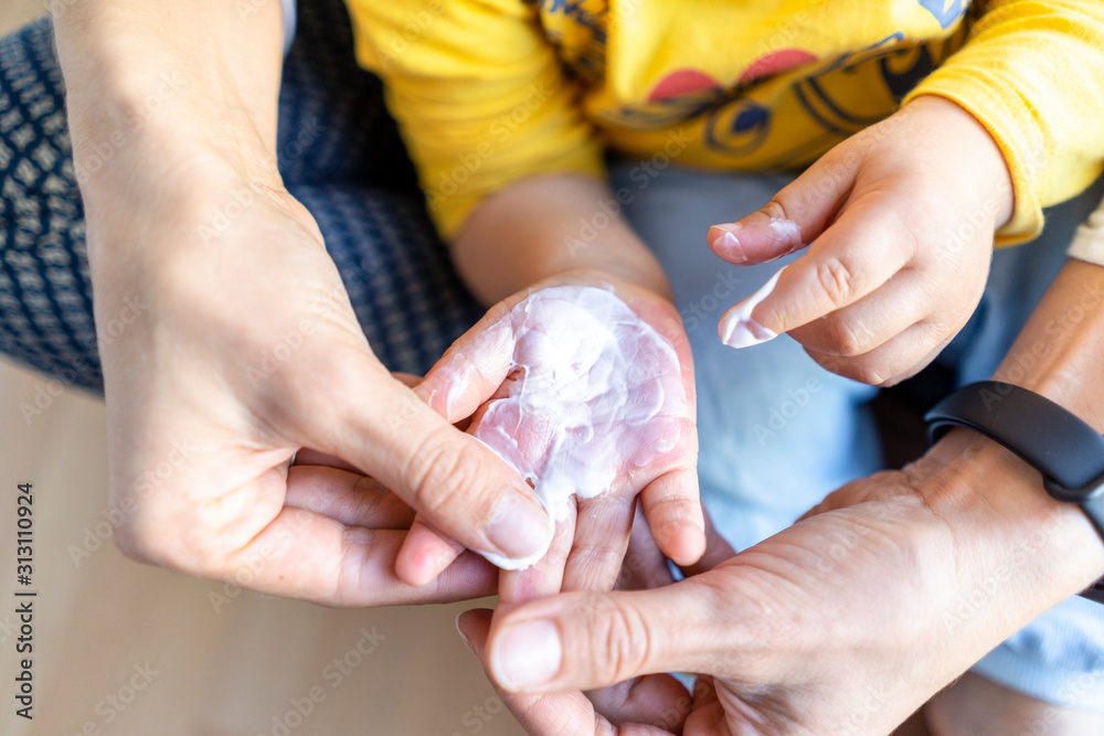 Mother applying white cream for burned hand of her son