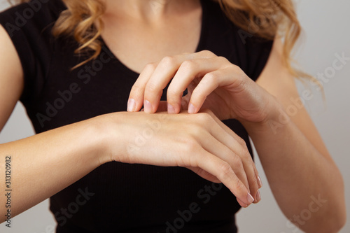 Skin disease concept. Woman with itchy hands