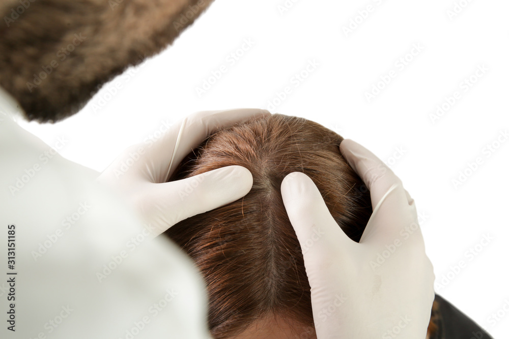 Doctor examining womans hair scalp, scalp eczema, dermatitis, psoriasis, hair loss, dandruff or