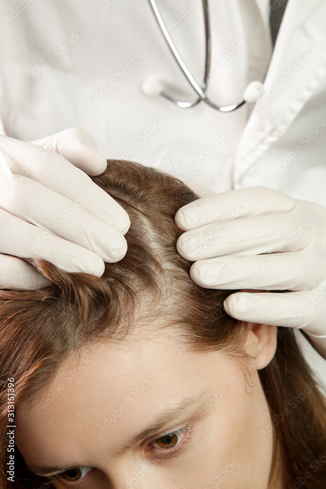 Doctor examining womans hair scalp, scalp eczema, dermatitis, psoriasis,  hair loss, dandruff or dry scalp problem Stock Photo | Adobe Stock