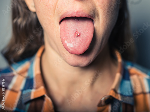 Εκτύπωση καμβά Close up on a woman's pierced tongue