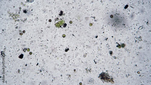 Diverse single-celled world of microorganisms and bacteria. Theme of laboratory biological research under microscope. Microscopic protozoa in a drop of water magnification. Microcosmic background photo