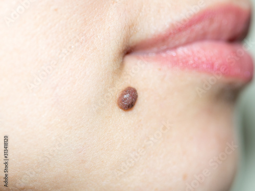 beautiful, female, red lips and mole close-up