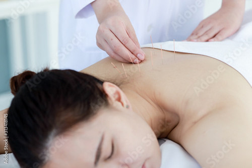 hand of doctor performing acupuncture therapy . Asian female undergoing acupuncture treatment with a line of fine needles inserted into the her body skin in clinic hospital