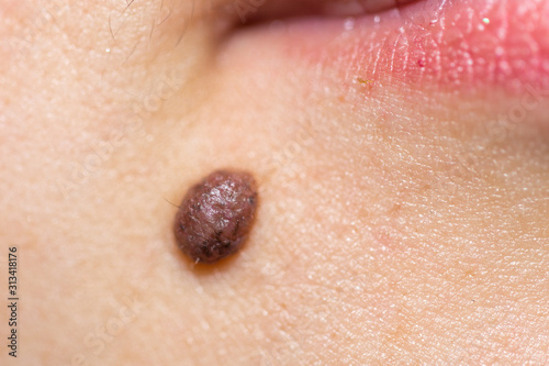 beautiful, female, red lips and mole close-up