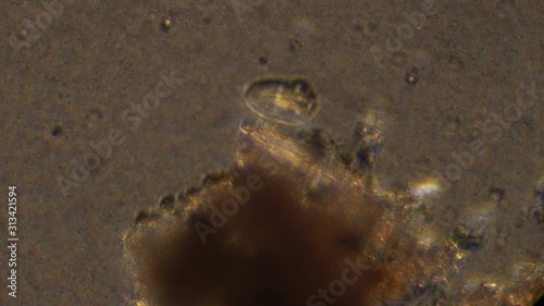 Microscopy of protozoa and small microorganisms in the water sample. Magnification 300x cell in active movement. photo