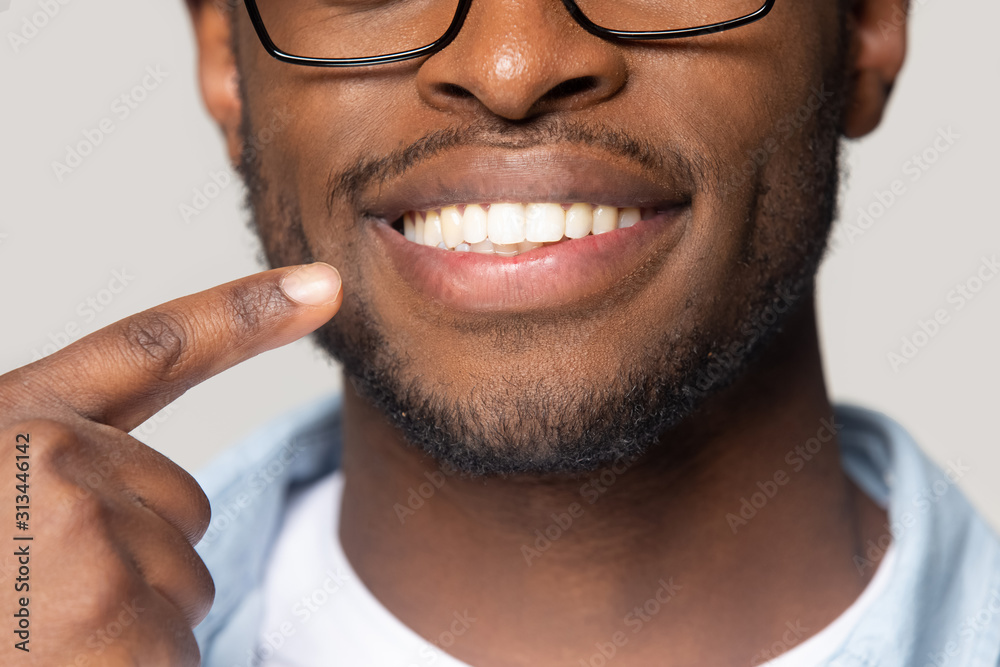 © fizkes - Closeup view african guy pointing finger to white toothy smile