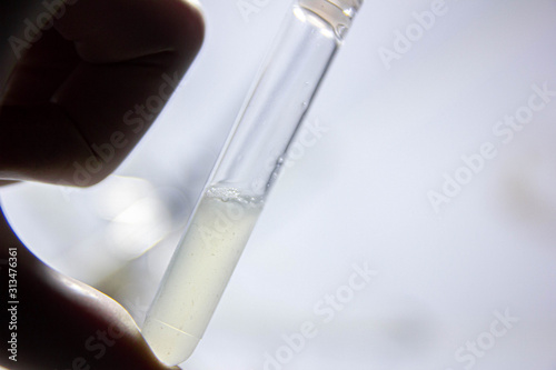 semen analysis in a medical center. sperm in vitro.