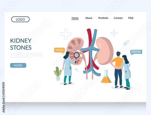 Kidney stones vector website landing page design template