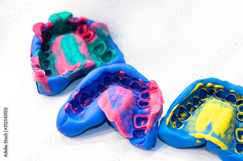 Casts of the jaw. Multi-colored plaster jaws. Career - dental technician. Anatomical teeth prints. Anatomical jaw of human. Preparation for the manufacture of dentures. Process of creating dentures. photo