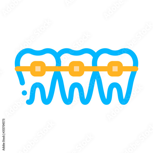 Dentist Stomatology Teeth Braces Vector Sign Icon Thin Line. Teeth Braces Bracket, Orthodontic Appliance Linear Pictogram. Chairside Assistance Dental Health Service Contour Illustration
