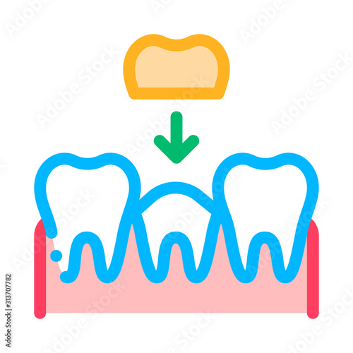 Stomatology Tooth Crown Vector Thin Line Sign Icon. Crown Dentist, Instrument Tool Equipment And Device Linear Pictogram. Medical Treatment Therapy Dentistry Contour Illustration