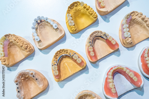Models of dentures of different types. Visual aid for students of the University of Medicine. Casts of the jaw. Training at the dentist. Anatomical teeth prints. Education for the orthodontist.