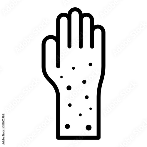 Hand allergy icon. Outline hand allergy vector icon for web design isolated on white background