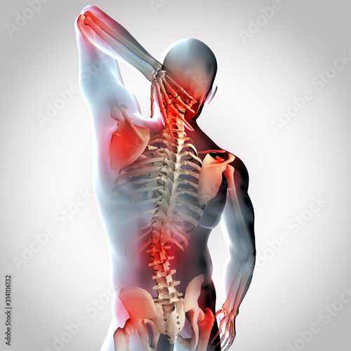 3D render of a male medical figure with joints highlighted