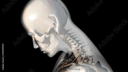 Whiplash Cervical Injury