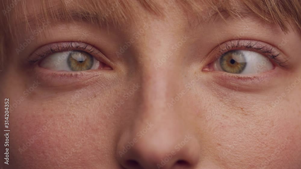 Woman with brown hair squinting, concept strabismus and squint. Close up, Woman with brown hair squinting, concept strabismus and squint. Close up,
