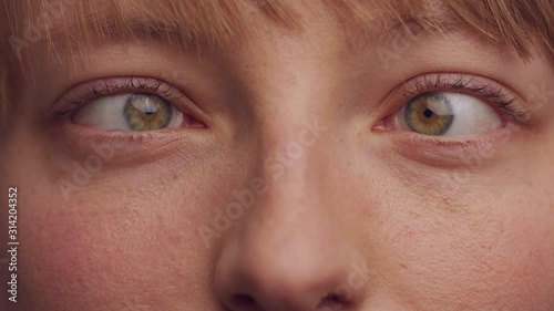 Woman with brown hair squinting, concept strabismus and squint. Close up, photo