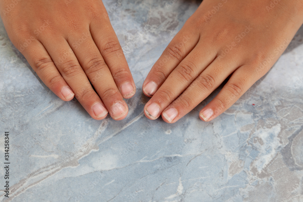 Nail clippers at your finger. Close up of fingernail cutting. Dirty nails. Long finger nails. Nail clippers at your finger. Close up of fingernail cutting. Dirty nails. Long finger nails.