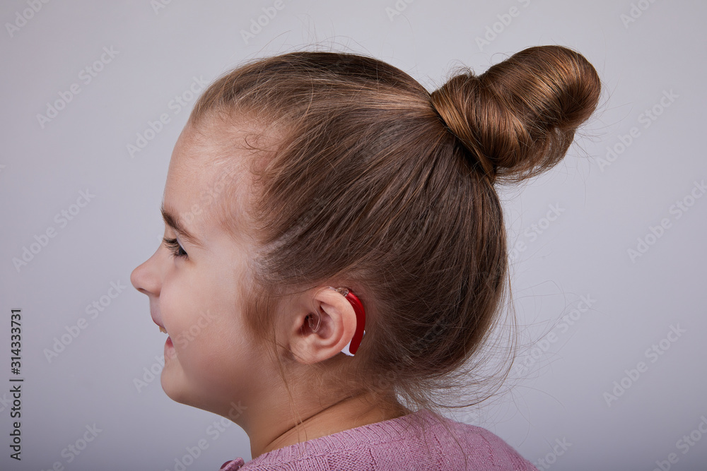  Hearing Aid in Young Girl's Ear. Toddler girl wearing a hearing aid. Studio shot