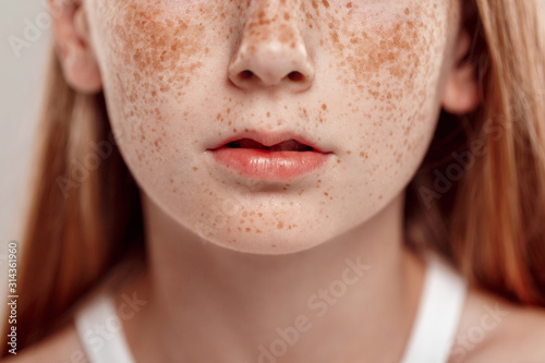 Inclusive Beauty. Girl with freckles standing isolated on grey lips close-up photo