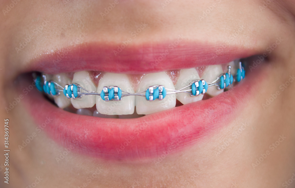 Obraz premium Dentadura 