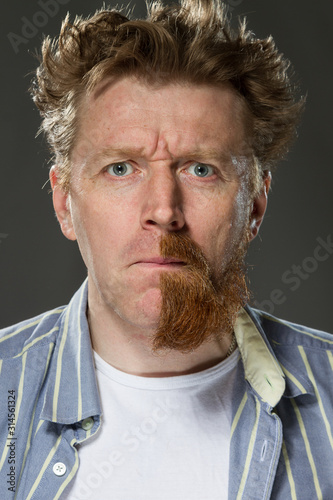  man with half red beard