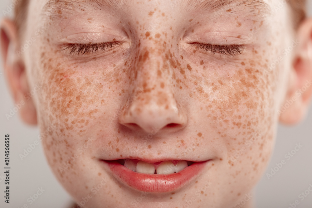 Inclusive Beauty. Girl with freckles standing isolated on grey clsoed eyes dreaming happy close-up Inclusive Beauty. Girl with freckles standing isolated on grey clsoed eyes dreaming happy close-up