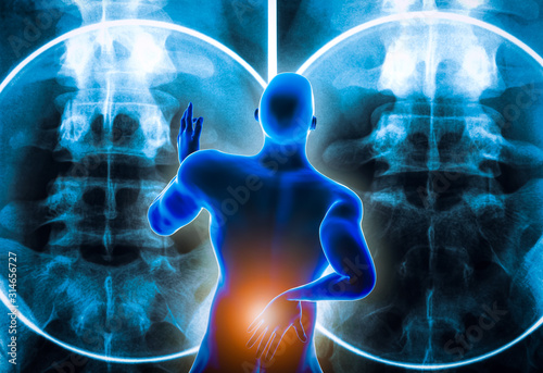 Back view of a man suffering from an acute lumbar back pain or discal hernia or lumbago with backbone x-ray imagery in the background. 3D rendering illustration. Back injury medical concept.