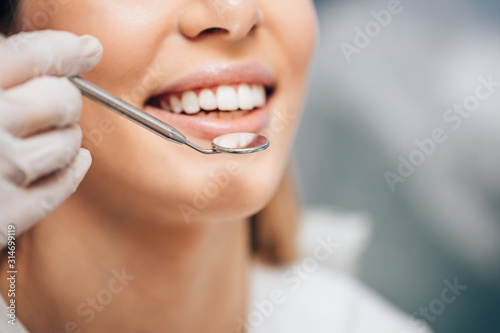 Cropped happy woman smiling  have ideal teeth. Sit on dental visit and smile  doctor use special mirror for examination of teeth
