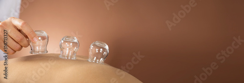 Person Giving Cupping Treatment