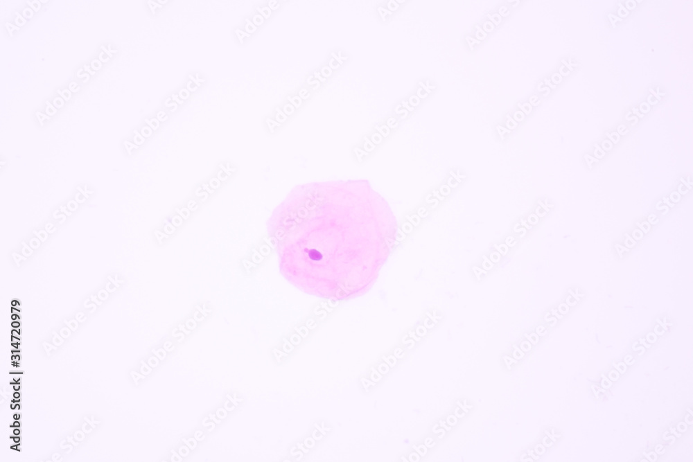 View in microscopic of normal human cervix cells.Squamous epithelium
