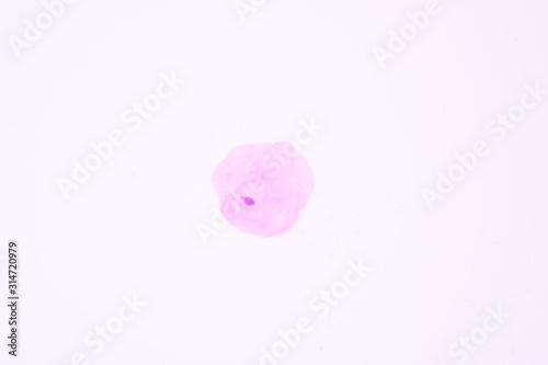 View in microscopic of normal human cervix cells.Squamous epithelium cells.Superficial epithelial cells.Cytology and pathology laboratory department.Magnification 600 X