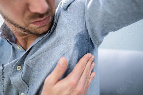 Canvas Print Man With Hyperhidrosis Sweating Very Badly