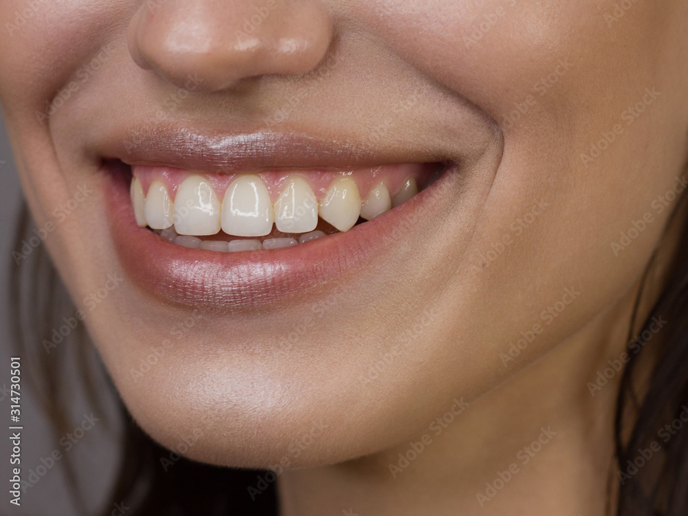 close-up portrait of a snow-white woman's smile for dentistry. Beautiful sexy full lips with natural lip gloss. smooth teeth and clean dark skin close-up portrait of a snow-white woman's smile for dentistry. Beautiful sexy full lips with natural lip gloss. smooth teeth and clean dark skin