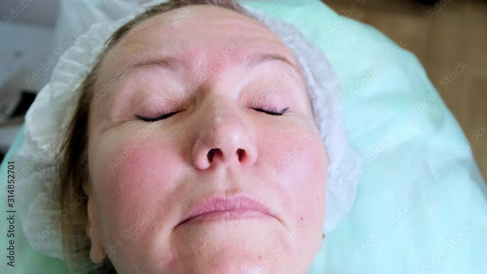 cosmetologist doctor prepares a woman's face for a cosmetic injection of Botox, injections of hyaluronic acid. Woman in a beauty salon. plastic surgery clinic cosmetologist doctor prepares a woman's face for a cosmetic injection of Botox, injections of hyaluronic acid. Woman in a beauty salon. plastic surgery clinic