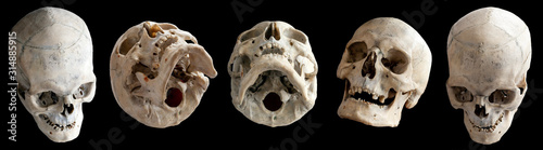 Human skull. Human anatomy. Collection of rotations of the skull. Skull at different angles. Isolated on black background.