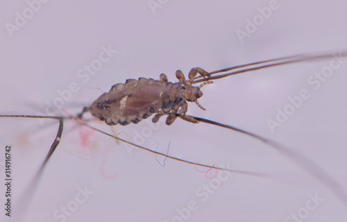 Canvas Print Macro Close Up  Pediculus humanus capitis head louse