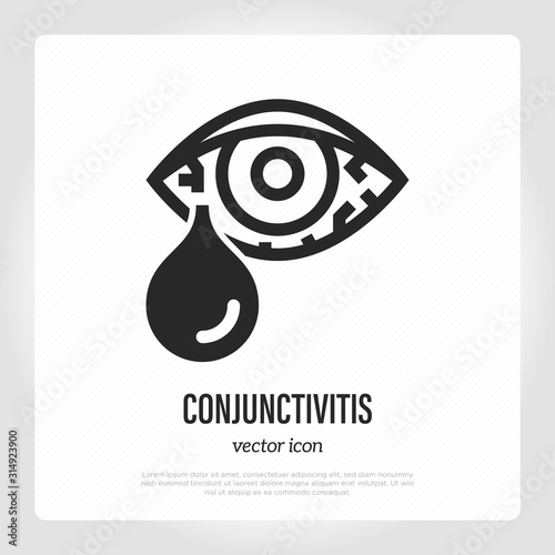 Conjunctivitis, eye allergy thin line icon. Symptom of adenovirus. Healthcare and medical vector illustration.