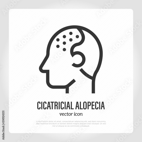 Cicatricial alopecia thin line icon. Hair loss. Bald place on scalp. Vector illustration.