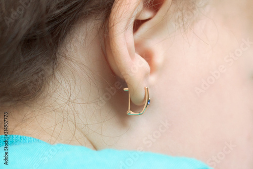 the puncture of ears to children is younger than three years