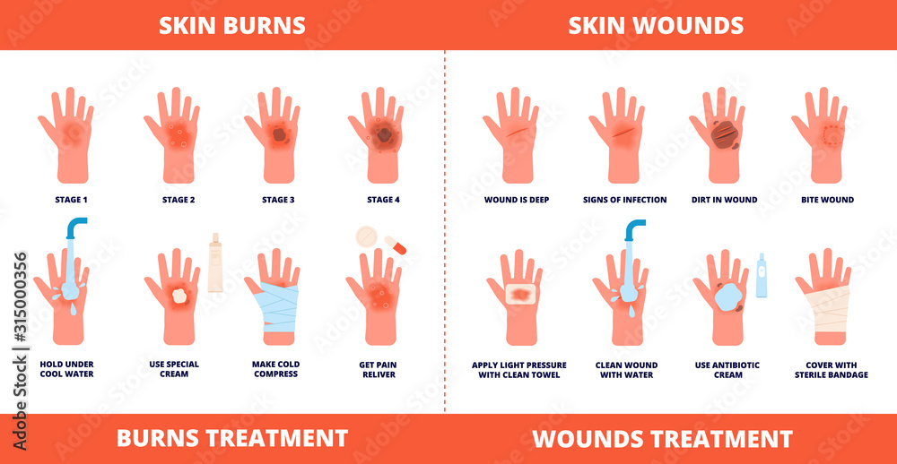 Skin first aid. Burns treatment, wounds and trauma symptoms. Degree