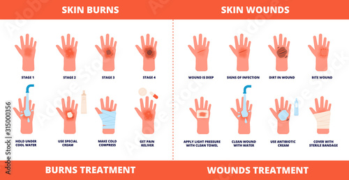 Skin first aid. Burns treatment, wounds and trauma symptoms. Degree burn, help hand healing with cream, bandaging and pills vector poster. Injury skin and wound care, treatment hurt illustration photo